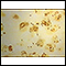 Legionnaire disease - organism legionella