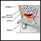 Patent urachus repair - series
