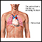 Pericardium