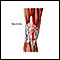 Tendinitis
