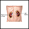 Kidneys