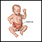 Infant intestines